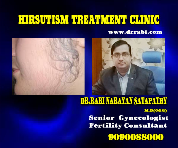 best hirsutism treatment clinic in bhubaneswar, odisha - dr rabi